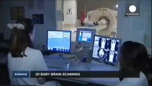 فناوری نوین MRI در تشخیص سلامتی جنین