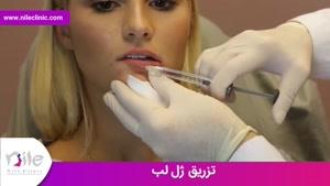 تزریق ژل | فیلم تزریق ژل | کلینیک پوست و مو نیل | شماره 7