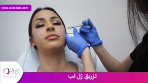 تزریق ژل | فیلم تزریق ژل | کلینیک پوست و مو نیل | شماره 12