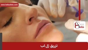 تزریق ژل | فیلم تزریق ژل | کلینیک پوست و مو هلیا | شماره 12