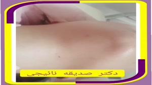 فیلم مزوتراپی غبغب در مطب دکتر صدیقه نائیجی متخصص پوست