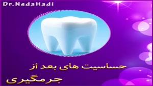 حساسیت های بعد از جرمگیری دندان