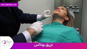 تزریق بوتاکس | فیلم تزریق بوتاکس | کلینیک پوست و مو نیل | شماره 16