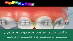 روش درست نخ دندان کشیدن