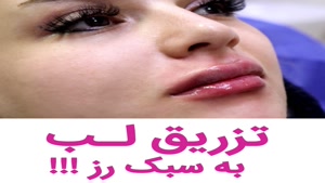 فیلم تزریق ژل | کلینیک رز | 02144067005 | شماره 102