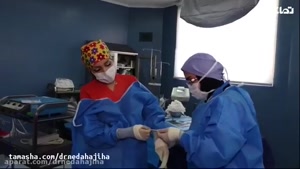 فیلم جراحی سزارین در تهران 