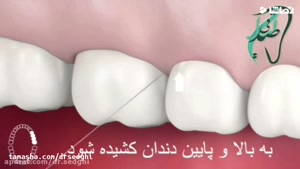 روش صحیح استفاده از نخ دندان 