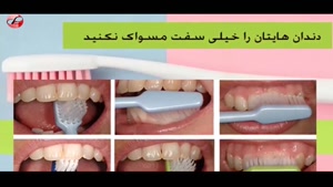 علت های پوسیدگی دندان