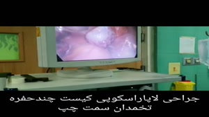 جراحی لاپاراسکوپی کیست تخمدان