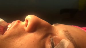 فیلم نمونه کار جراحی بینی فوق تخصص پلاستیک و زیبایی