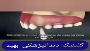 فیلم درمان شکستگی دندان 