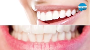 راهکار داشتن دندان سفید و درخشان
