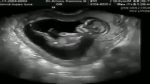 سونوگرافی دوران بارداری