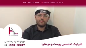 کاشت مو میکروگرافت | کلینیک هلیا | 02122810089 | شماره 60