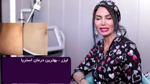 درمان استریاها وترک های پوستی با لیزر