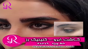 فیلم کاشت ابرو | کلینیک رز | 02148679 | شماره 229