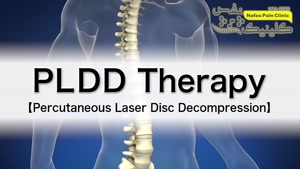 درمان دیسک کمر با لیزر