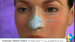 تجميل الأنف في  مركز جراحة التجميل إيران