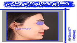 جراحی بینی در شیراز 