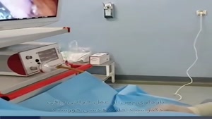 بارداری پس از عمل جراحی