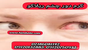  انواع کرم قوی ضد چین و چروک دور چشم/۰۹۱۲۰۷۵۰۹۳۲/کرم اصل 