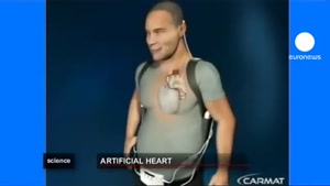قلب مصنوعی 5ساله