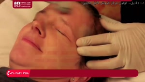 آموزش پاکسازی صورت - درمان با درمارولر