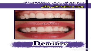 زیبای دندان در مشهد 