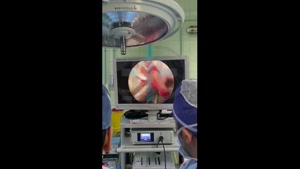 عمل جراحی دکتر رضا اشراقی با دوربین Surgical Camera 