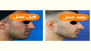 اصلاح روابط فکی دکتر مهدی سزاوار