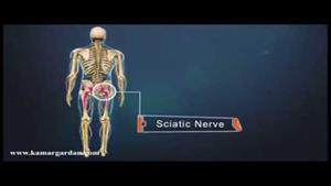 عصب سیاتیک - رگ سیاتیک