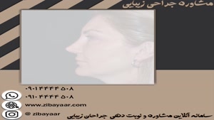 هزینه عمل بینی قوزدار در تهران 