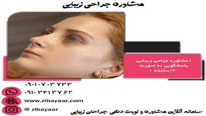 بینی انحرافی