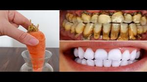 سفید شدن دندان با مواد طبیعی