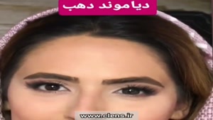 لنز طوسی عسلی دور دار | 09129346645 | سی لنز	