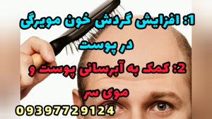 درمان تضمینی ریزش مو در طی سه هفته بدون عوارض و صددرصد گیاهی