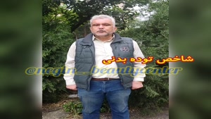 ابدومینوپلاستی  برای بی ام آی بالای ۳۵، دکتر حمید ملکان راد 