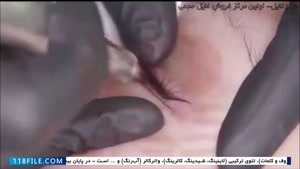 آموزش تتو صورت - آموش فیبروز - خط چشم دائمی 