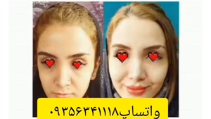 قرص چاقی میخوای؟ واتساپ۰۹۳۵۶۳۴۱۱۱۸ پیام بده