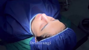 فیلم عمل بینی در اتاق عمل | دکتر سعید شیرنگی