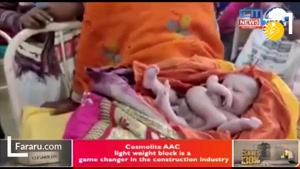 به دنیا امدن نوزاد عجیب الخلقه در هند