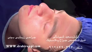 نتیجه عمل بینی طبیعی در آقایان - بهترین جراح بینی در تهران