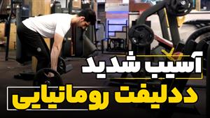 آسیب شدید ددلیفت رومانیایی romanian deadlift