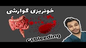 خونریزی گوارشی |GI BLEEDING |علایم