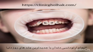 ارتودنسی دندان در کلینیک دندانپزشکی قلهک