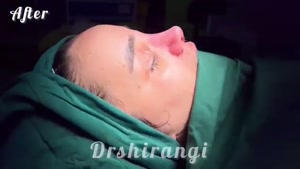 جراح بینی با رتبه برتر در تهران