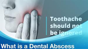 آبسه دندان چیست - What is a dental abscess