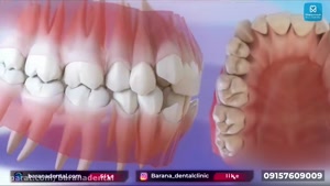 ارتودنسی و دندانپزشکی کودکان مشهد 