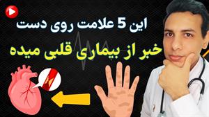 تشخیص بیماری قلبی از روی علائم روی دست 