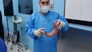 جراحی اسلیو معده توسط دکتر علی الماسی 